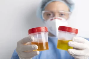 Apa Itu Penyakit Hematuria, Bagaimana Penanganannya? 1 Apa Itu Penyakit ‘Hematuria’