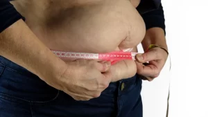 Berikut Jenis Kanker yang Dipicu oleh Obesitas