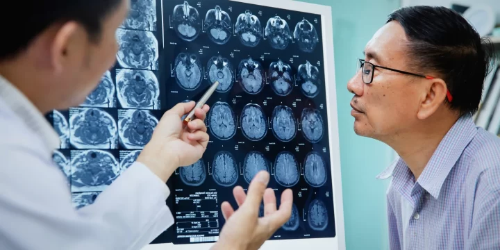 Kenali Diffuse Axonal Injury, Cidera Kepala Parah