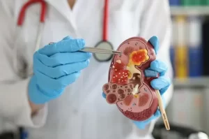 Ciri-ciri Kanker Ginjal